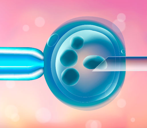 inyección intracitoplasmática fisiológica