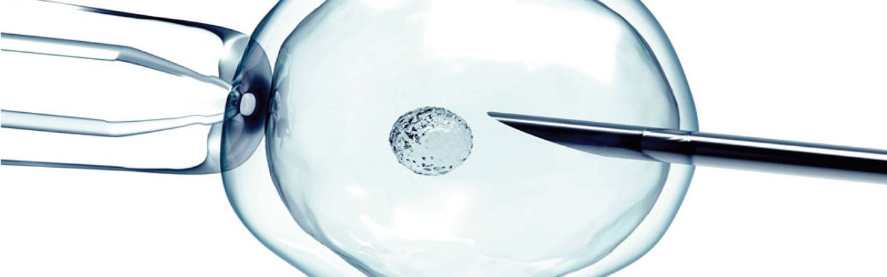 ¿Cómo me preparo para una fertilización in vitro?