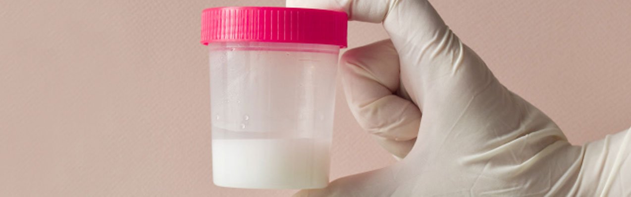 Lavado de seminal para inseminación intrauterina