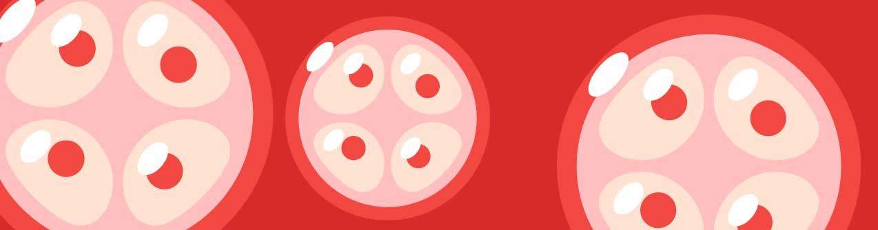 Quiero mejorar mi receptividad endometrial