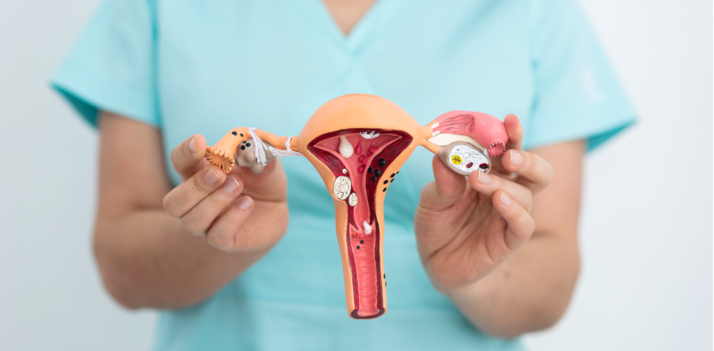 inseminación intrauterina