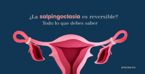 ¿La salpingoclasia es reversible? Todo lo que debes saber