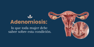 Adenomiosis: lo que toda mujer debe saber sobre esta condición