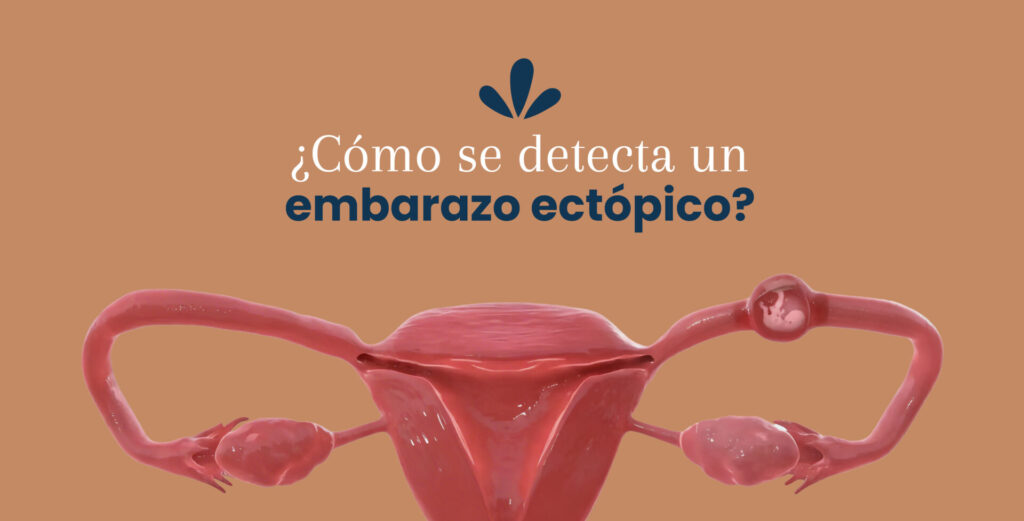 ¿Cómo se detecta un embarazo ectópico?