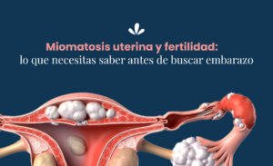 Miomatosis uterina y fertilidad: lo que necesitas saber antes de buscar embarazo