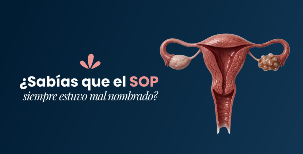 ¿Sabías que el SOP siempre estuvo mal nombrado?