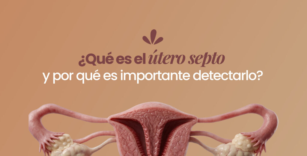 ¿Qué es el útero septo y por qué es importante detectarlo?