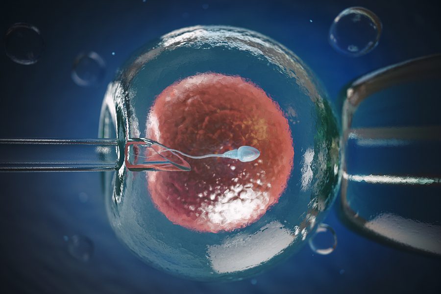 Inyección Intracitoplasmática (ICSI) | Procrea
