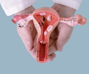 doctor Gynecologist holds model of female reproductive system in the hands. Help and care concept